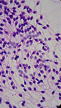 Human spermatozoon, frotis semen sample photo