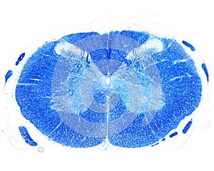 Human spinal cord. Luxol fast blue stain