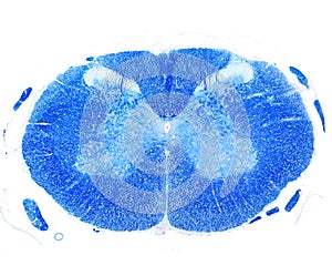 Human spinal cord. Luxol fast blue stain