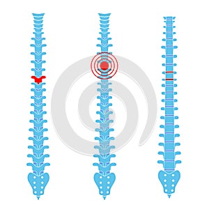 Human spine pain vector illustration photo