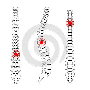 Human spine pain vector illustration photo