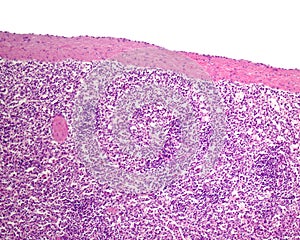 Small intestine. Paneth cells