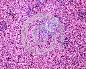 Human spleen. Lymphoid follicle