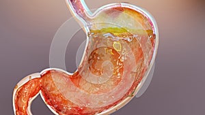 human stomach with gases. Bloating and flatulence, flatulence and gastrointestinal tract, Bloating digestion system, stomach ache