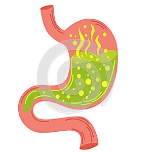 Human stomach. Gastritis and acid reflux, indigestion, vomiting, heartburn and stomach pain problems. Unhealthy stomach concept.