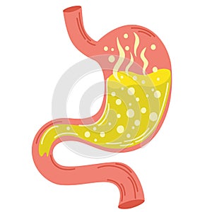 Human stomach. Gastritis and acid reflux, indigestion, vomiting, heartburn and stomach pain problems. Unhealthy stomach concept.