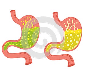 Human stomach set. Gastritis and acid reflux, indigestion, vomiting, heartburn and stomach pain problems. Unhealthy stomach