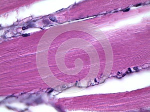 Human striated muscle under microscope photo