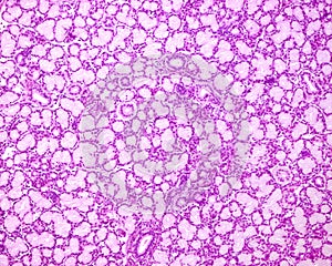 Human sublingual gland photo