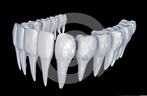 Human Teeth instalation. Medically accurate dentistry anatomy