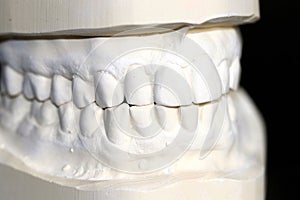 Human teeth made of plaster