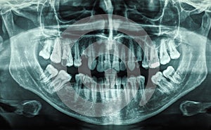 Human teeth xray
