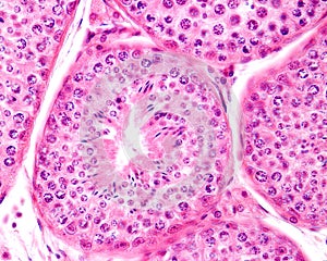 Human testicle. Seminiferous tubules photo