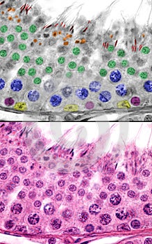 Human testicle. Spermatogenesis photo