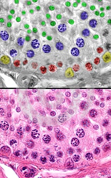 Human testicle. Spermatogenesis