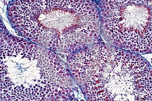 Human testis under the light microscope view. Shows spermatogonia, spermatocytes in meiosis, spermatids, and spermatozoa photo