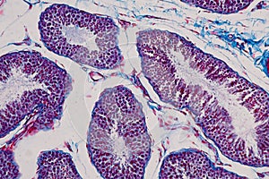 Human testis under the microscope view.