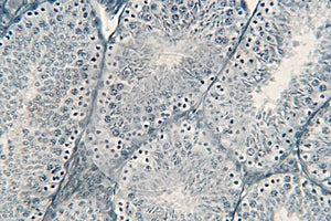 Human testis under microscope view.