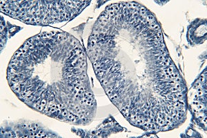 Human testis under microscope view. photo