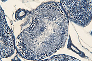 Human testis under microscope view. photo