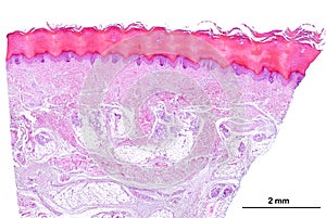 Human thick skin. Sole of the foot