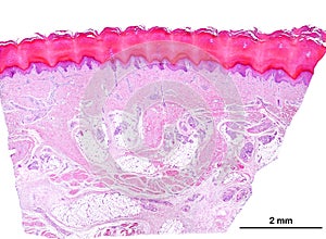 Human thick skin. Sole of the foot