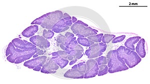 Human thymus. Cortex and medulla