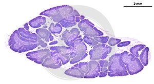 Human thymus. Cortex and medulla