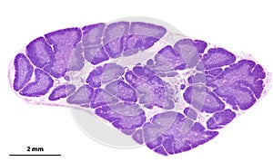 Human thymus. Cortex and medulla photo