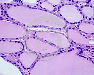 Human thyroid gland. Thyroid follicle epithelium