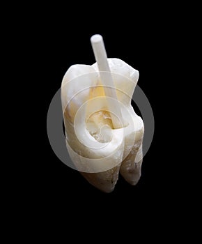 Human tooth with fiber resin post