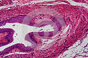 Human transitional epithelium under the microscope