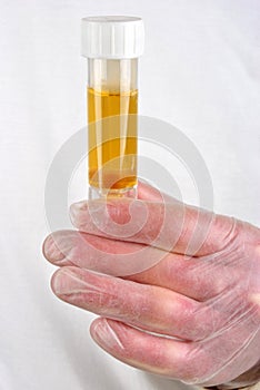 human urine in a sample bottle