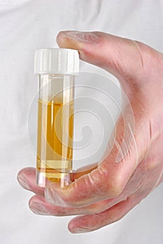 human urine in a sample bottle