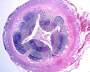 Human vermiform appendix