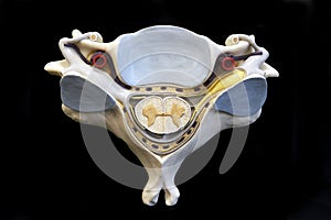 Human Vertebra