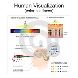 Human Visualization Color blindness.