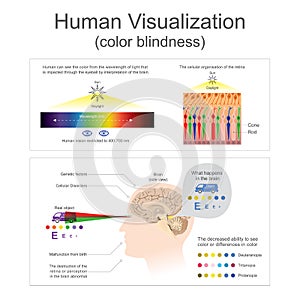 Human Visualization Color blindness. photo
