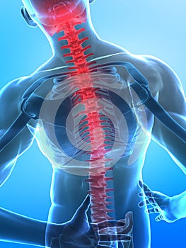 Hombre columna vertebral 