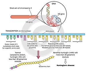 Huntington's disease