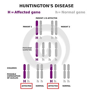 Huntington\'s disease genetics. Autosomal dominant inheritance. photo