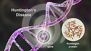 Huntington's disease, a neurodegenerative disease due to mutation in the huntingtin gene, HTT, conceptual 3D