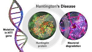 Huntington's disease, a neurodegenerative disease due to mutation in the huntingtin gene, HTT, conceptual 3D