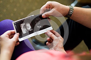 The husband and th looking at sonogram while lying photo