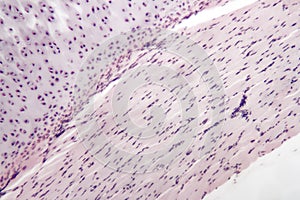 Hyaline cartilage