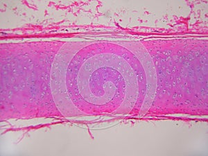 Hyaline Cartilage with chondrocytes photo