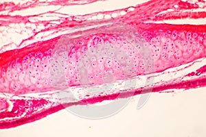 Hyaline cartilage of human trachea