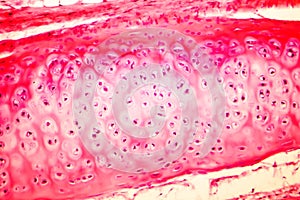 Hyaline cartilage of human trachea photo