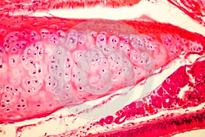 Hyaline cartilage of human trachea