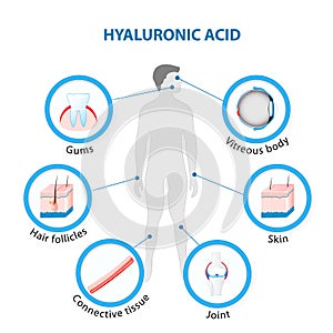 Hyaluronic Acid